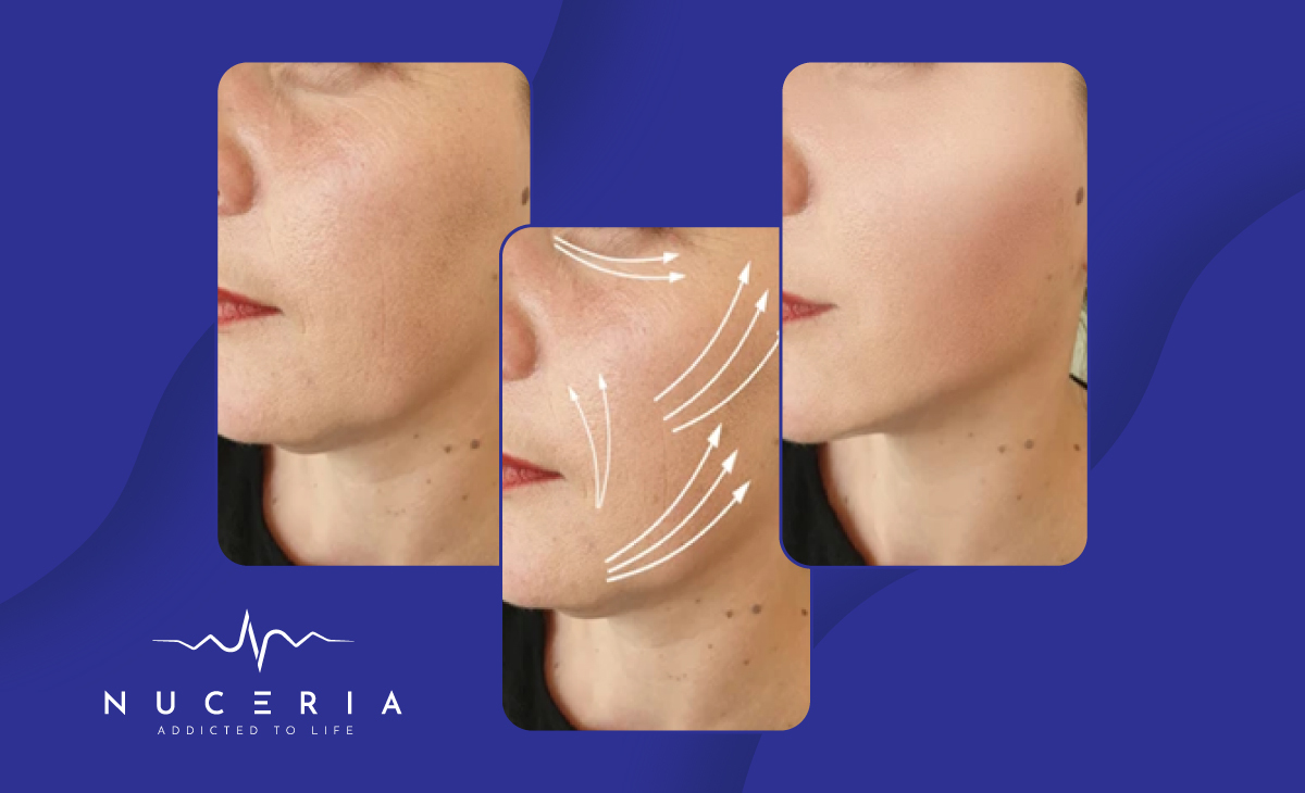 which is more effective oral or iv glutathione Glutathione for Skin: IV vs. Oral – Which Works Better?