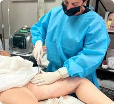 Waterjet Assisted Liposuction