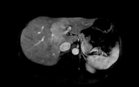 pelvis-scan