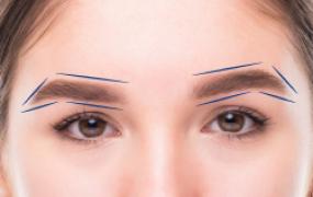 eyebrow-or-foxtail-lift