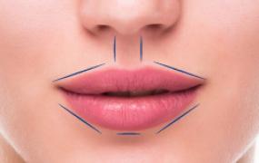 LINING VERMILLION BORDER OF IIPS &  DEFINING CUPIDS BOW