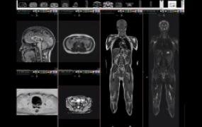 FULL BODY SCAN w/ HEART ECHOCARIOGRAM