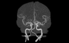 brain-scan