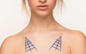 Decolletage Lift