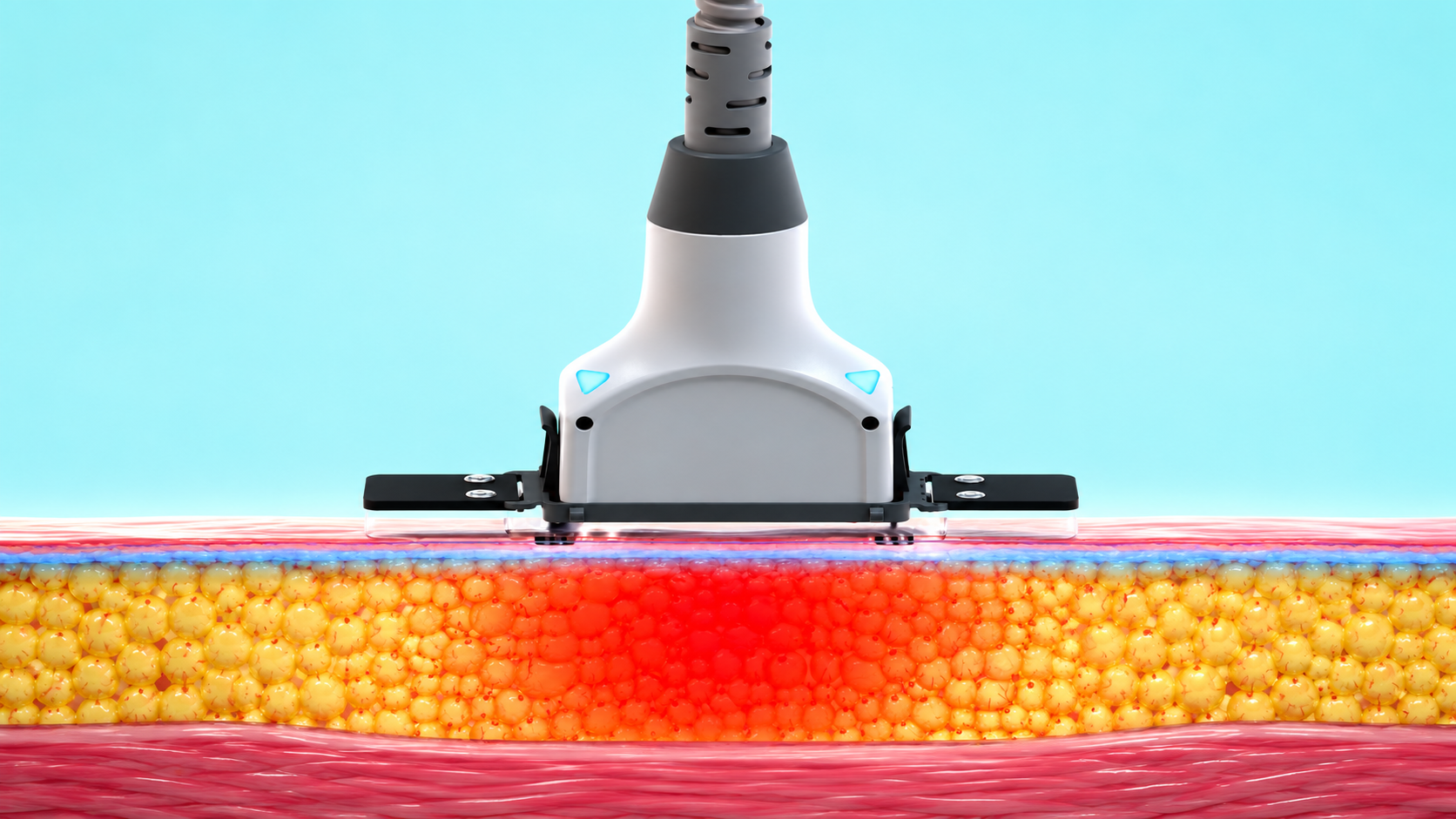 DioSculpt Applicator on Skin