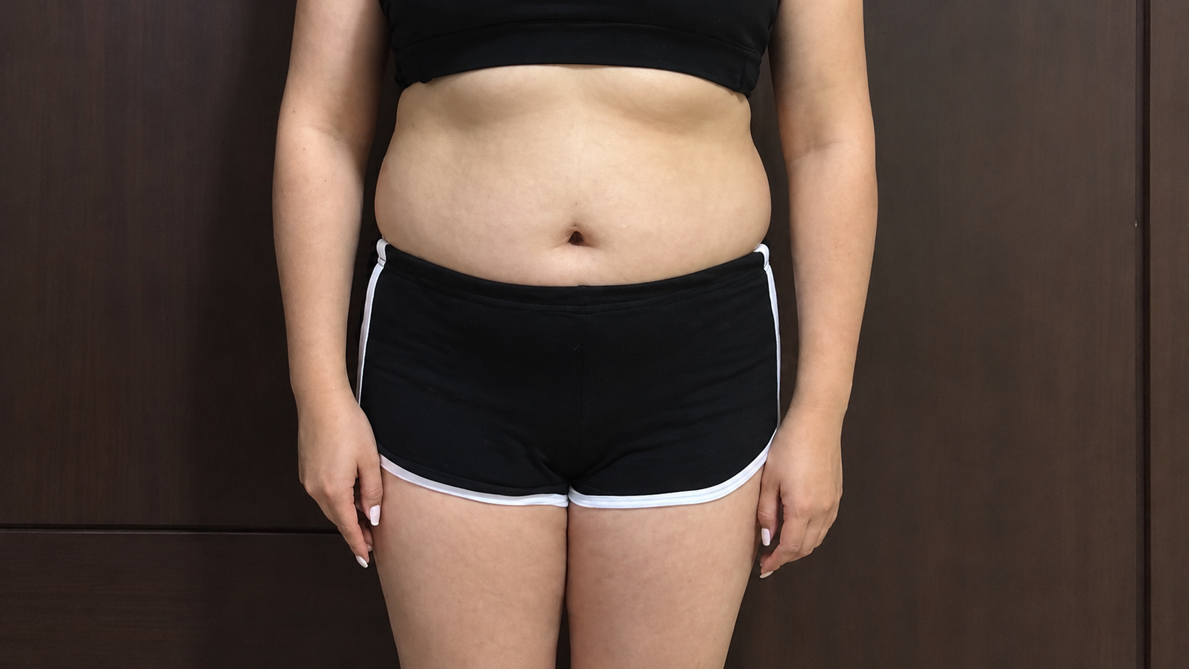 Before diosculpt