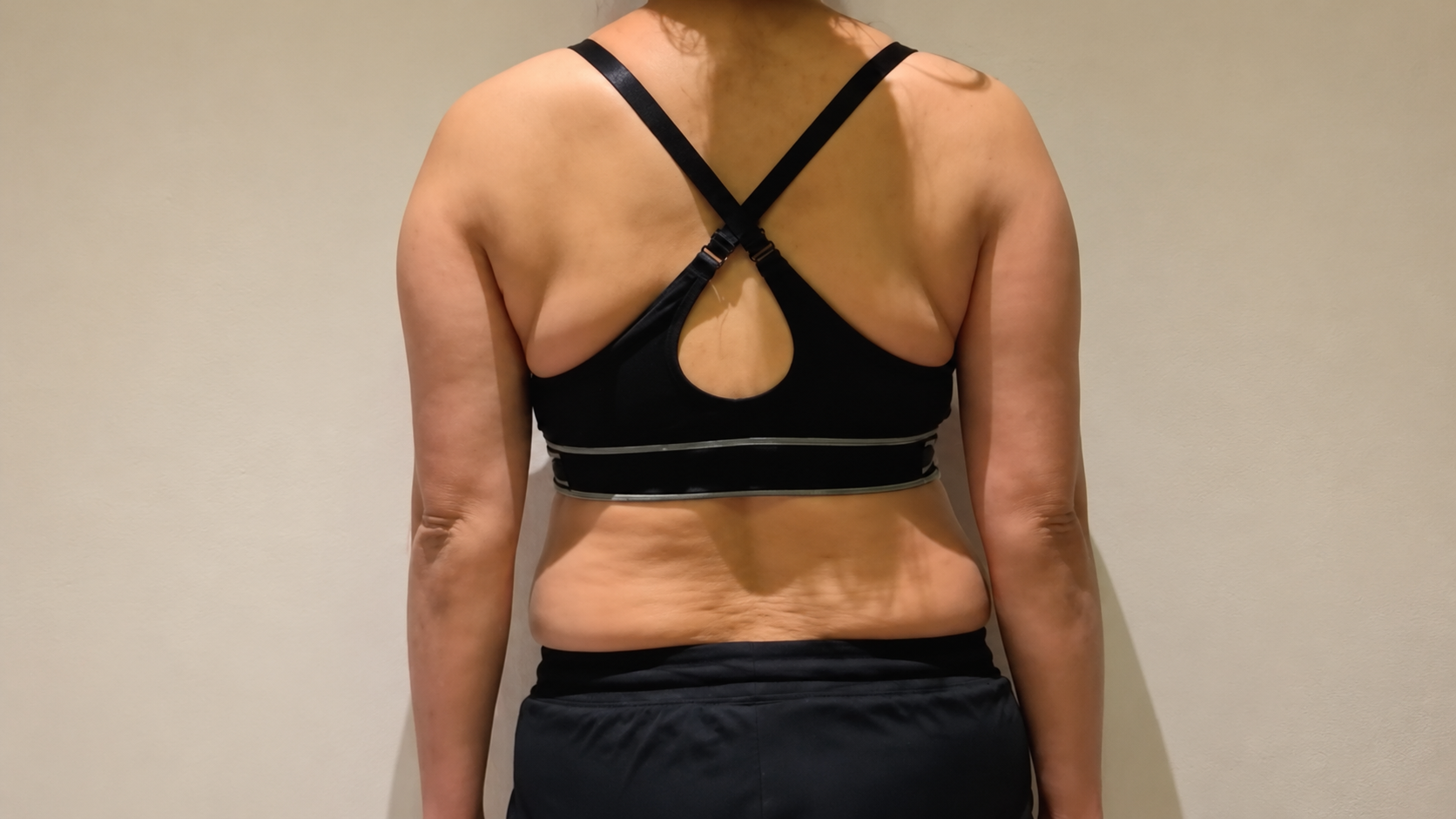 Before diosculpt