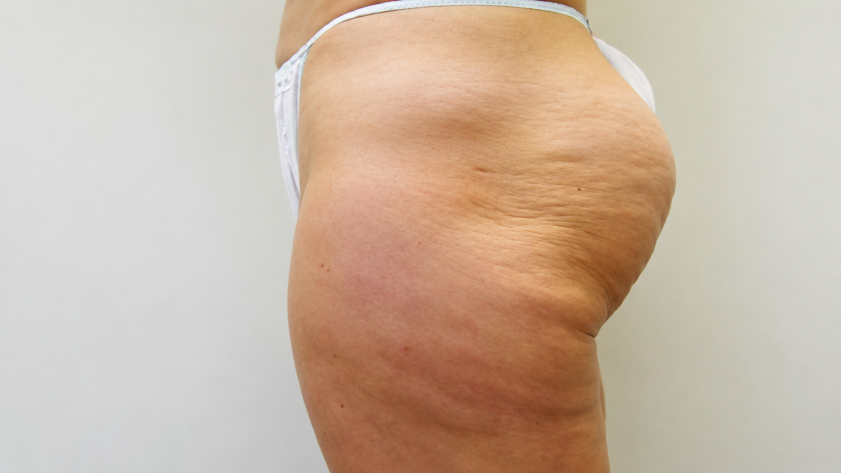 Before diosculpt